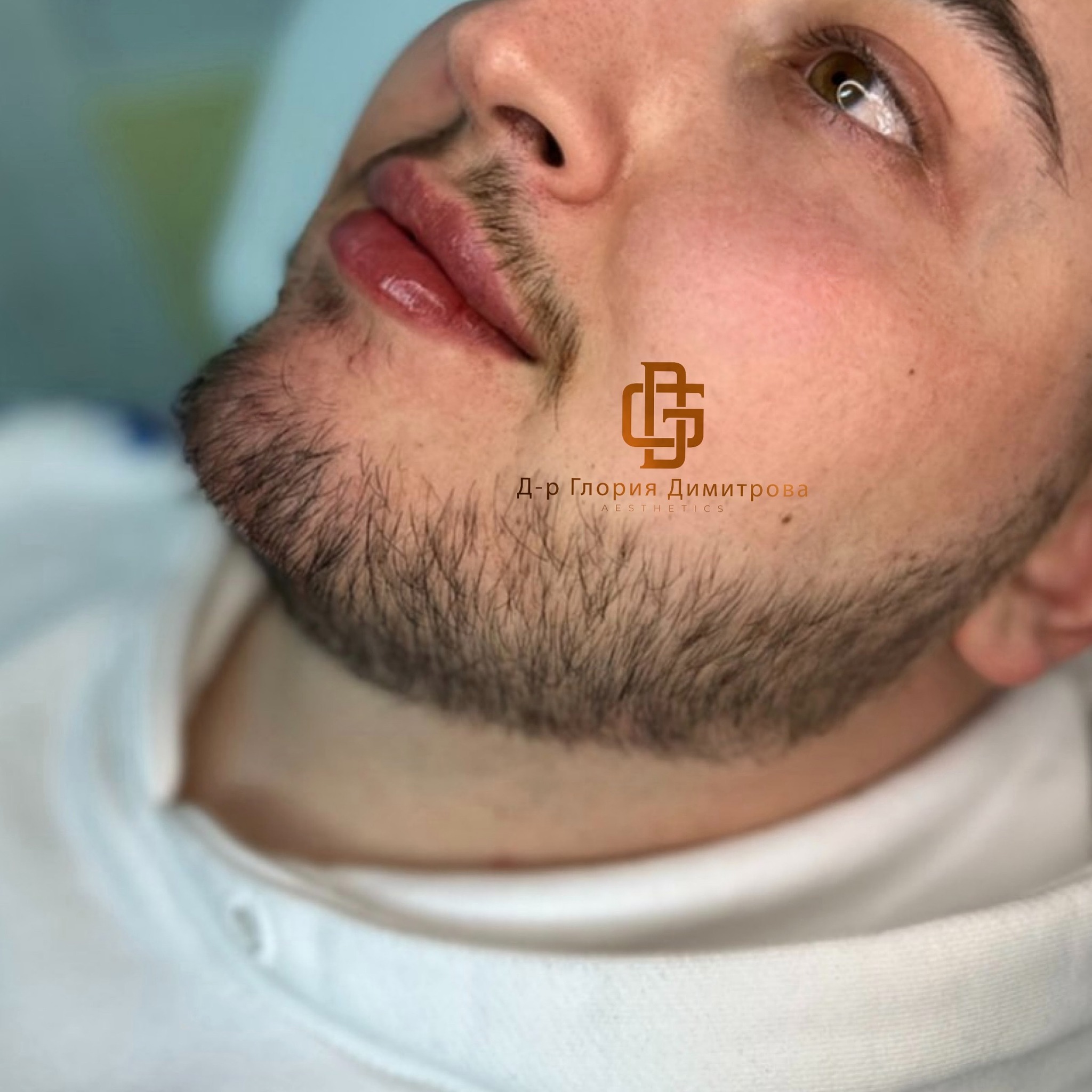 Преди и след